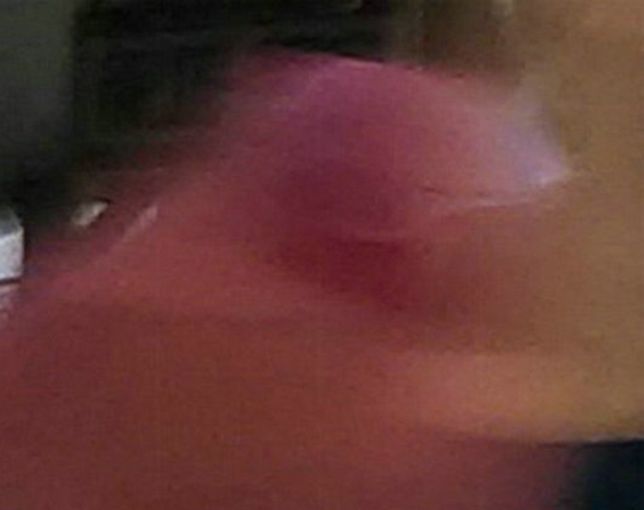 疑似灵界甲嘴